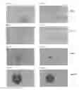 Fig. 08 - METHOD FOR PICKING A COLONY OF CELLS