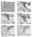 Fig. 03 - Multiples multiplex immunohistochemical assay using primary antibodies of the same host species