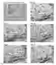 Fig. 04 - Multiples multiplex immunohistochemical assay using primary antibodies of the same host species