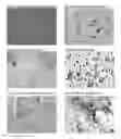 Fig. 05 - Multiples multiplex immunohistochemical assay using primary antibodies of the same host species