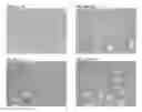 Fig. 10 - Multiples multiplex immunohistochemical assay using primary antibodies of the same host species
