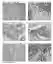Fig. 12 - Multiples multiplex immunohistochemical assay using primary antibodies of the same host species