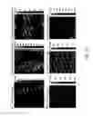Fig. 14 - Method and device of using a scanning probe microscope