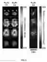 Fig. 05 - Multiband, multishot magnetic resonance elastography