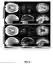 Fig. 06 - Multiband, multishot magnetic resonance elastography