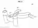 Fig. 03 - Surgical microscope device and surgical microscope system