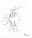 Fig. 04 - Tear shaping for refractive correction