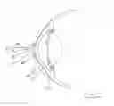 Fig. 08 - Tear shaping for refractive correction