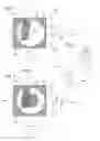 Fig. 02 - Mechanical timepiece movement with a resonator having two degrees of freedom with a maintaining mechanism using a runner rolling on a track