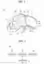 Fig. 03 - Head mounted display device