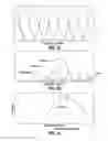 Fig. 12 - Device and method for orientation and positioning
