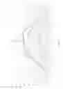 Fig. 08 - Dead zone compensation for touch screens