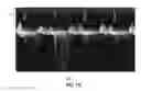 Fig. 11 - Automatic discrepancy detection in medical data