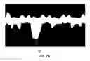 Fig. 12 - Automatic discrepancy detection in medical data