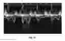 Fig. 13 - Automatic discrepancy detection in medical data