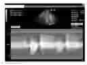 Fig. 01 - Cross-modality neural network transform for semi-automatic medical image annotation