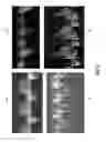 Fig. 03 - Cross-modality neural network transform for semi-automatic medical image annotation