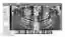 Fig. 01 - Producing panoramic radiograph