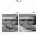 Fig. 07 - Method and apparatus for obtaining high-quality textures