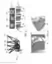Fig. 04 - METHOD AND SYSTEM FOR SEMANTIC SEGMENTATION IN LAPAROSCOPIC AND ENDOSCOPIC 2D/2.5D IMAGE DATA