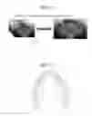 Fig. 08 - Producing panoramic radiograph