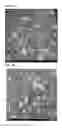 Fig. 04 - Particulate active material, power storage device positive electrode, power storage device, and production method for particulate active material