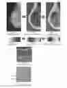Fig. 11 - System and method for the visualization and characterization of objects in images