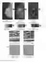 Fig. 17 - System and method for the visualization and characterization of objects in images