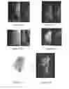 Fig. 28 - System and method for the visualization and characterization of objects in images