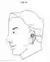 Fig. 10 - Earphone device