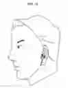 Fig. 13 - Earphone device