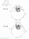 Fig. 17 - Earphone device