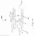 Fig. 08 - HEARING DEVICE AND A METHOD FOR PROTECTING COMPONENTS OF A HEARING DEVICE