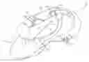 Fig. 01 - Easy Access Articles of Footwear