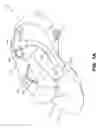 Fig. 02 - Easy Access Articles of Footwear