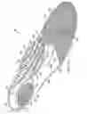 Fig. 02 - Contoured support shoe insole