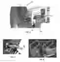 Fig. 05 - Retractable endoscopic suction tube