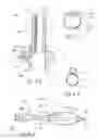 Fig. 07 - Methods and apparatus for treating disorders of the ear nose and throat