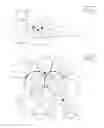Fig. 02 - Apparatus and method for intravascular catheter navigation using the electrical conduction system of the heart and control electrodes
