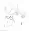 Fig. 03 - Apparatus, systems, and methods for detecting congenital heart disease in newborns