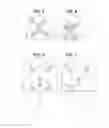 Fig. 06 - Apparatus, systems, and methods for detecting congenital heart disease in newborns