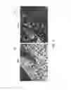 Fig. 07 - Early detection of reduced bone formation with an NMR scanner