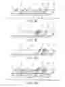 Fig. 04 - NASAL IRRIGATION DIAGNOSTIC DEVICE