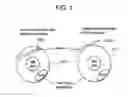 Fig. 02 - Devices and methods for surgical retraction