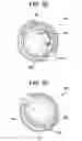 Fig. 09 - Devices and methods for surgical retraction