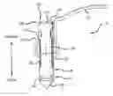 Fig. 01 - Knotless suture anchor for soft tissue repair and method of use