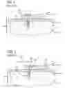 Fig. 02 - Knotless suture anchor for soft tissue repair and method of use