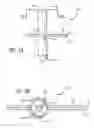 Fig. 04 - Knotless suture anchor for soft tissue repair and method of use