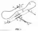 Fig. 02 - DEVICES, SYSTEMS AND METHODS FOR A PILOTING TIP BUSHING FOR ROTATIONAL ATHERECTOMY