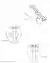 Fig. 15 - Bone fixation apparatus